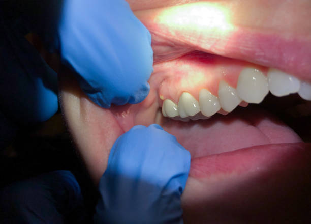 Best Urgent Dental Care for Toothaches in Palmer, TX