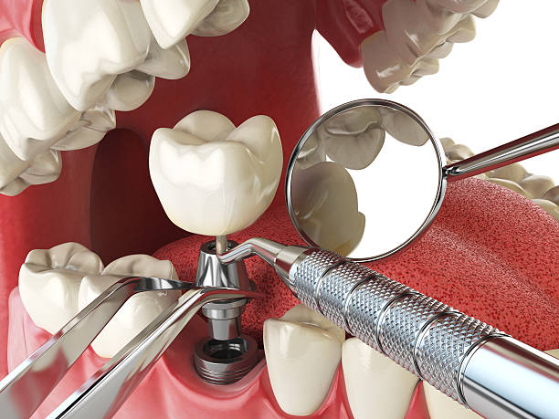 Best Emergency Treatment for Oral Infections in Palmer, TX
